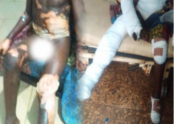 Ebonyi teenager thrown into fire for allegedly stealing rice