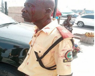 Man faces prosecution for assaulting LASTMA official