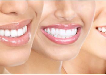 5 natural ways to make your teeth white and shiny