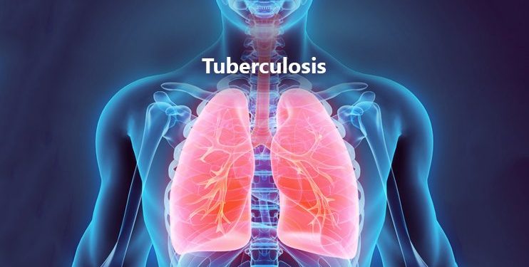Health Commissioner educates citizens on tuberculosis prevention