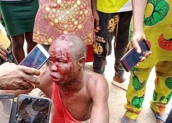 Serial fraudster escapes death