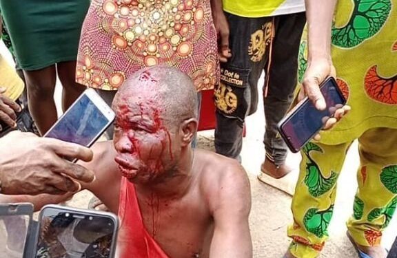 Serial fraudster escapes death