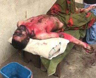 Dumped lady burns self, ex-fiancé to death in Aba