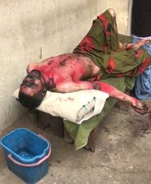 Dumped lady burns self, ex-fiancé to death in Aba