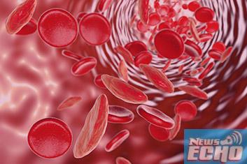 Anambra lawmaker promises elimination of sickle cell