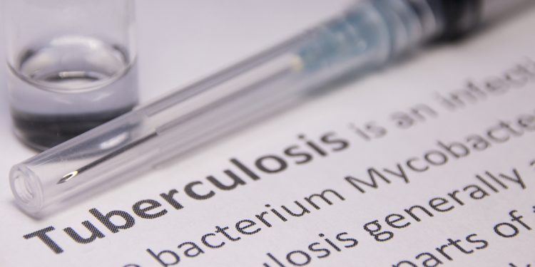 World TB Day: Group warns against indiscriminate spitting to avoid tuberculosis