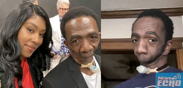 Man Born Without A Jaw Finally Finds Love As He Gets Married (photos)