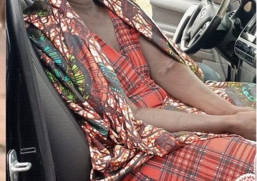 Woman flogged for witchcraft lands hospital as Ikpeazu’s wife rescues her