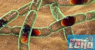 Anthrax disease: Imo govt sets up Public Health Alert Surveillance Team