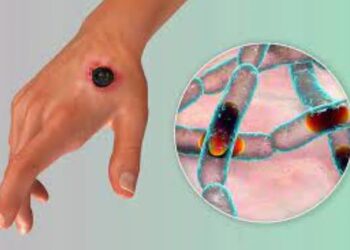 Moving against outbreak, spread of Anthrax