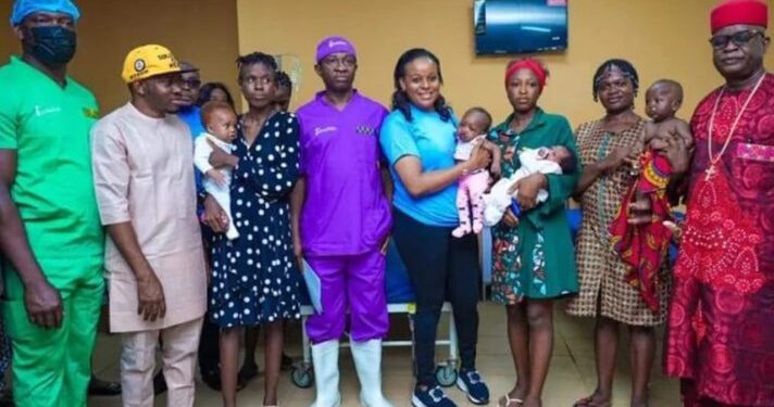 5 children to benefit from free cleft lip surgeries in Anambra