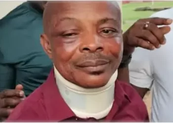 Brutalized NLC President to undergo brain Scan, Opthalmic Investigation