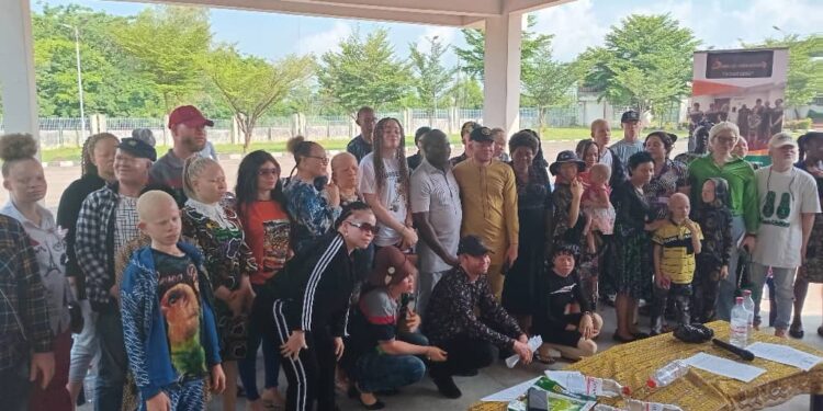 Skin cancer; Anambra Albinism community call for support, lunch trust fund to mark int’l day 