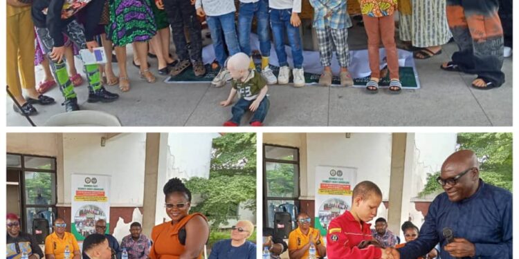 2025 Int’l Day of Albinism: Anambra records zero loss, unveils Vivygold Foundation