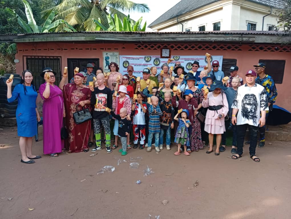 Albinism Association Advocates Proper Skin Care